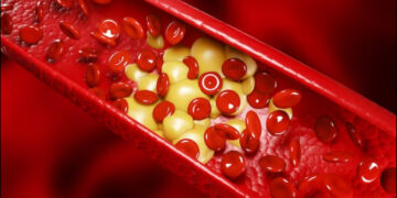 What does cholesterol work in the body? Why does it become dangerous when growing - India tv hindi
