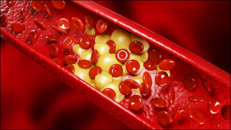 What does cholesterol work in the body? Why does it become dangerous when growing - India tv hindi