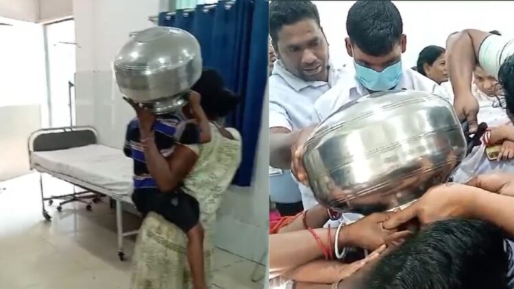4 -year -old child's head stuck in a steel vessel, doctors saved their lives like this - India tv hindi