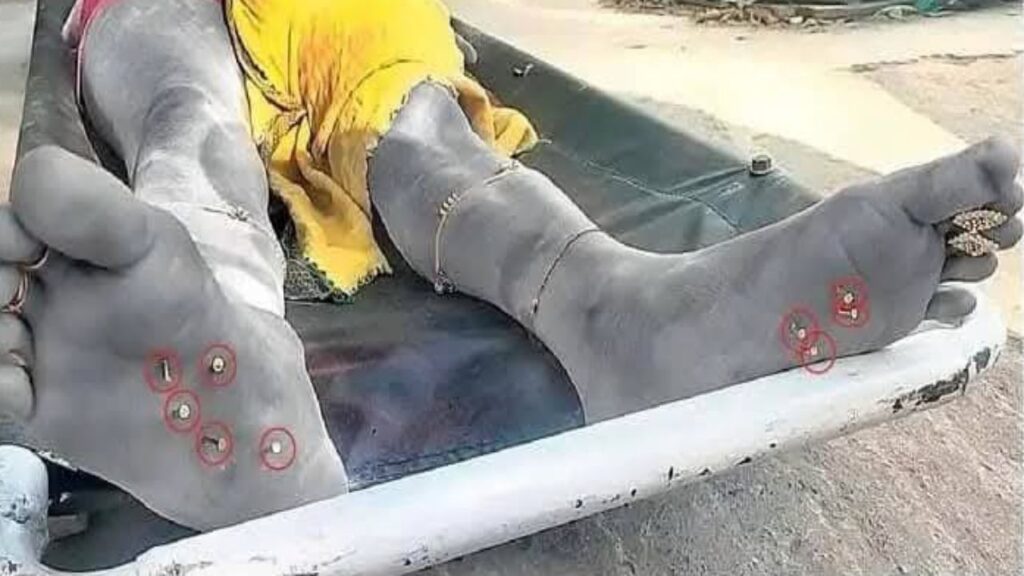 Bihar News | Bihar ki taza khabar | Bihar Crime | Bihar Crime News in Hindi | Bihar Police | Bihar ki taza khabar in hindi | Newstrack | The bandage on the hand, the nails were buried in the soles of the feet .. The soul of the people shivered after seeing the body of the girl. News Track in Hindi