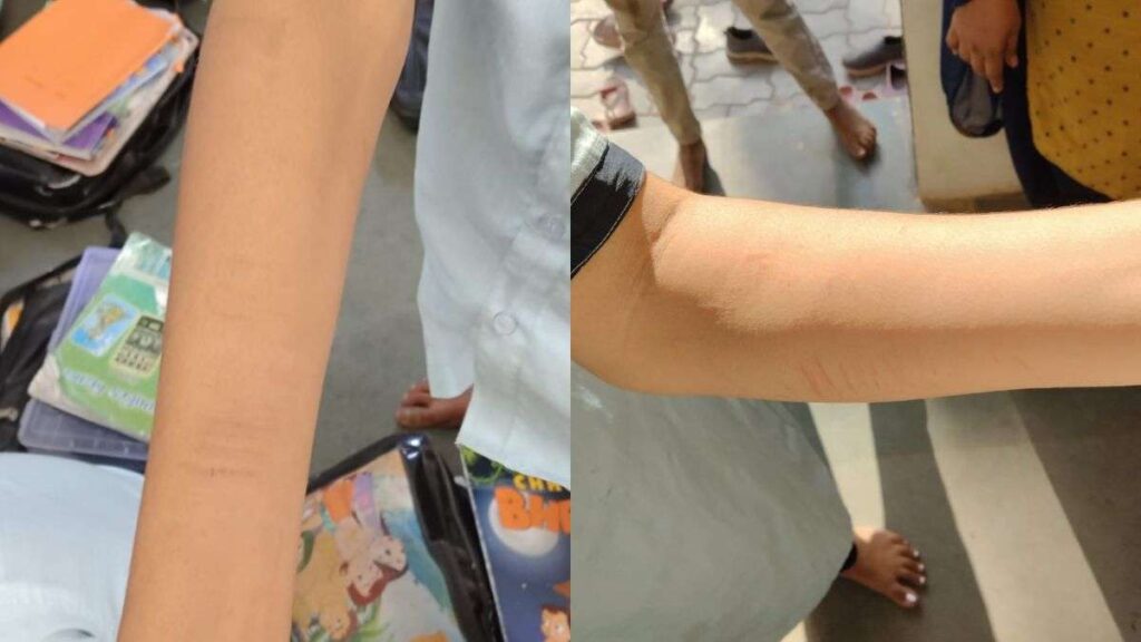 'Dare Game' or 'Danger Game'! 40 students injured themselves with blade in Amreli - India tv hindi