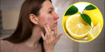 Do not forget to apply lemon juice on the face, these people may have trouble - India tv hindi