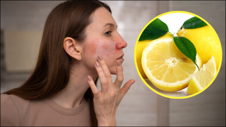 Do not forget to apply lemon juice on the face, these people may have trouble - India tv hindi