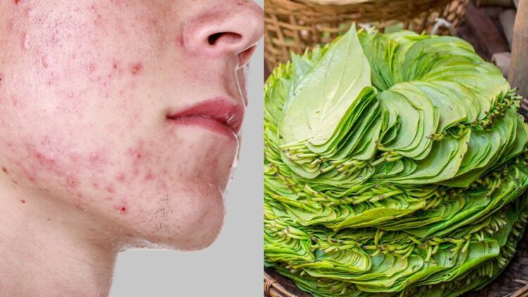 Paan leaf is beneficial in these skin problems, learn how to do this in skin care - India tv hindi
