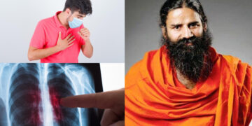 Swami Ramdev told effective home remedies to get rid of TB, lungs will be strong - India tv hindi