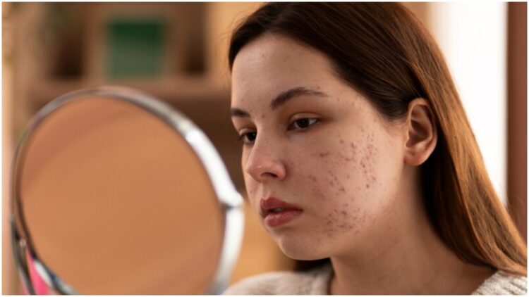 The face is filled with stains, so make these 2 things kept in the kitchen face pack - India tv hindi
