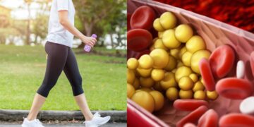 These signs start appearing in the body after walking, then understand that bad cholesterol - India tv hindi