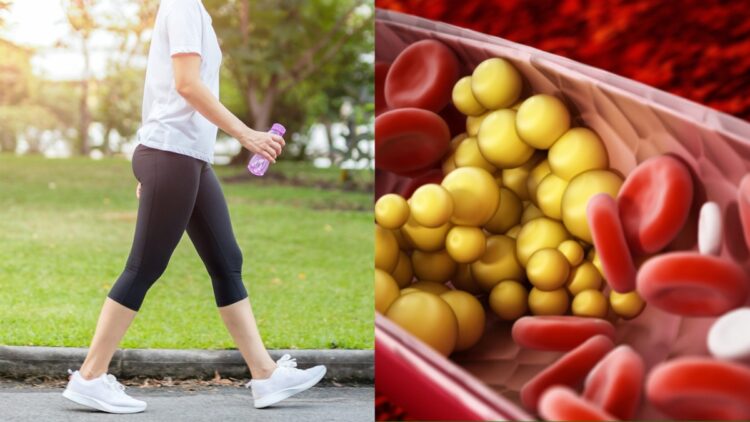 These signs start appearing in the body after walking, then understand that bad cholesterol - India tv hindi