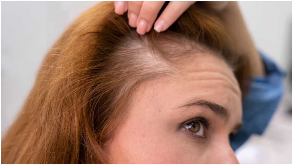 Treating a panacea of ​​broken hair, use this hair pack made of fenugreek seeds - India tv hindi