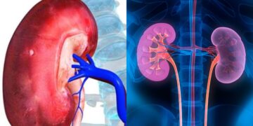 Why does the kidney start getting damaged? Make distance from these things today to stay healthy - India tv hindi