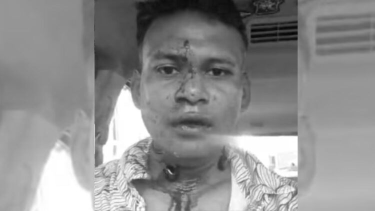 Bengaluru News | Karnataka News | Wing Commander | Wing Commander Attack | Wing Commander Viral Video | Karnataka Police | , Bengaluru News: Video of blood -soaked Air Force Officer viral, attacked the middle path, misbehavior with wife | News Track in Hindi