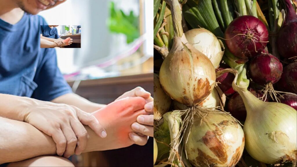 Consuming onion is beneficial in controlling uric acid, know how to use? - India tv hindi
