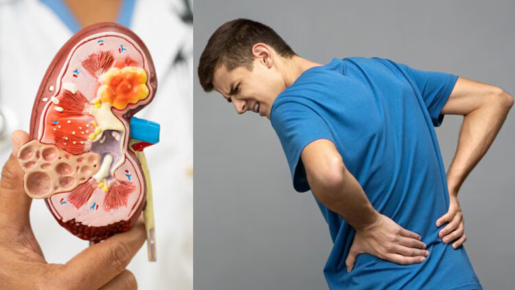 Kidney's killer becomes your habits, do not improve, otherwise kidney failure - India tv hindi