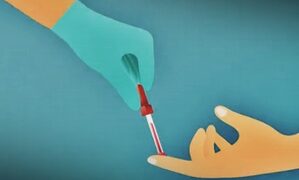 New blood test expected Parkinson's disease to be identified early