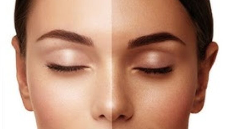 Tanning panacea for tanning, mix these two things, get glowing skin - India tv hindi
