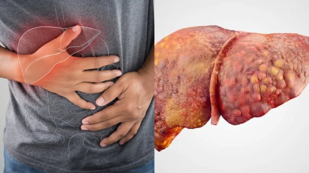 These symptoms start appearing when liver malfunction, learn from experts saving the liver from rotting - India tv hindi