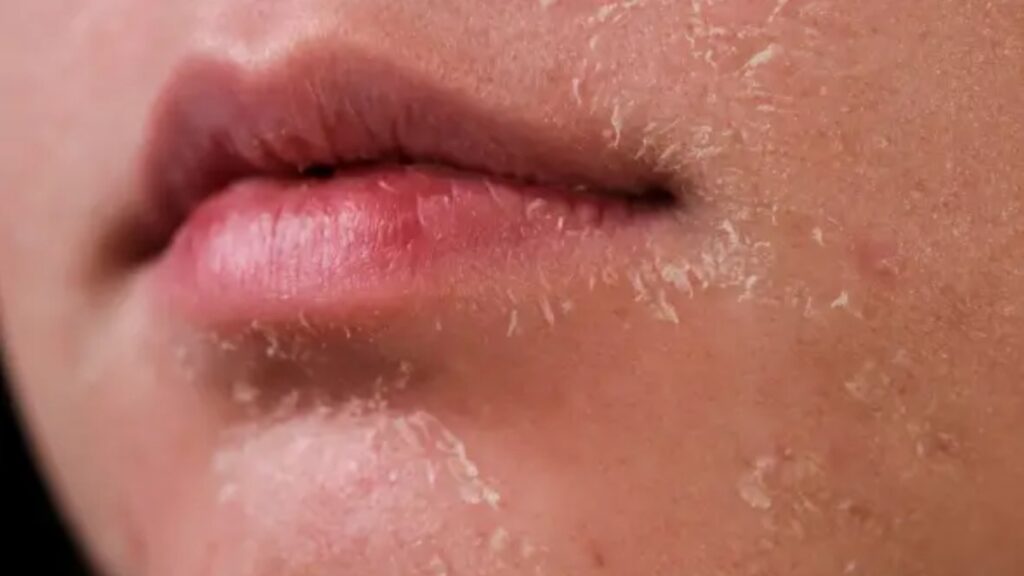 Your skin is also dry even if you do not forget to make these mistakes or else the face will be more dry - India tv hindi