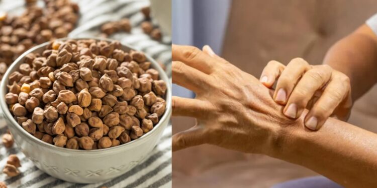 Can you eat gram in uric acid? Learn this food rich in protein is beneficial or harmful