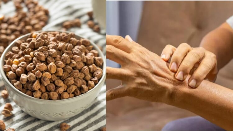 Can you eat gram in uric acid? Learn this food rich in protein is beneficial or harmful