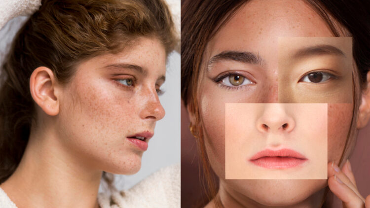Deep and black freckles will become clean, stains will also disappear, do these remedies