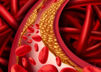 Dirty to dirty cholesterol frozen in veins will be holiday, heart health will be better, just