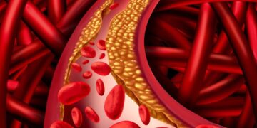 Dirty to dirty cholesterol frozen in veins will be holiday, heart health will be better, just