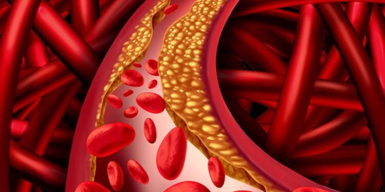 Dirty to dirty cholesterol frozen in veins will be holiday, heart health will be better, just