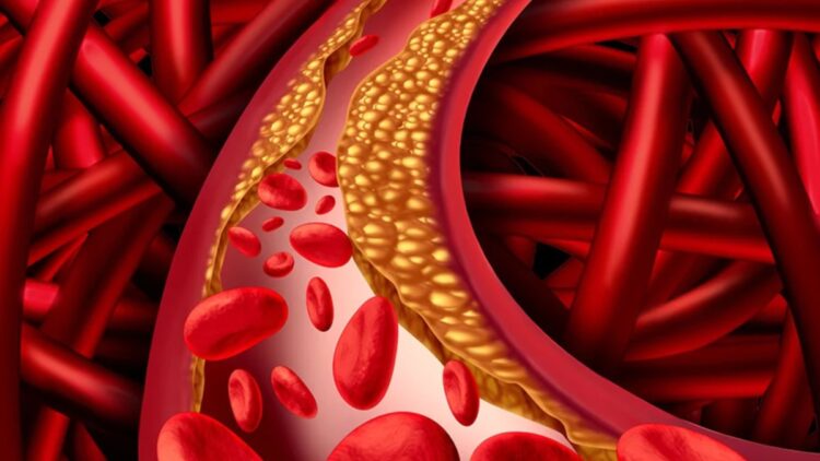 Dirty to dirty cholesterol frozen in veins will be holiday, heart health will be better, just