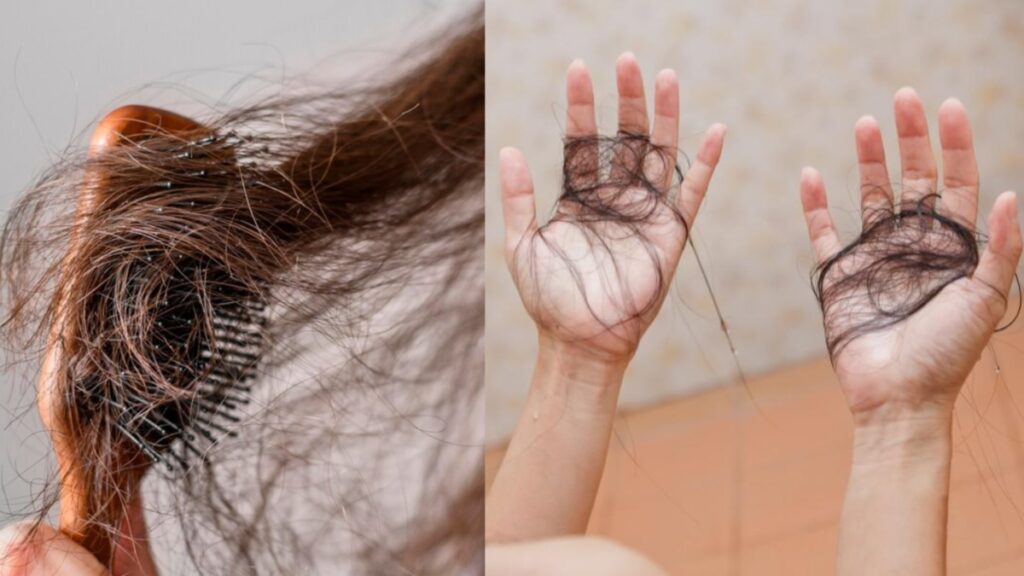 Due to increase in this hormone in the body, hair starts falling like leaves, it seems in bunches