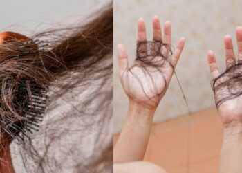 Due to increase in this hormone in the body, hair starts falling like leaves, it seems in bunches