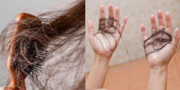 Due to increase in this hormone in the body, hair starts falling like leaves, it seems in bunches