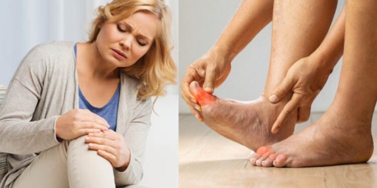 Due to these reasons, women start growing, uric acid problem, joint pain becomes uncontrollable, know how to control?