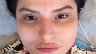 फेशियल एक्यूपंक्चर: चेहरे की चमक बढ़ाने के साथ कई समस्याओं का समाधान है छोटी सी ‘सुई’
