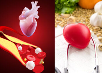 Home remedies to reduce cholesterol, include these things in diet