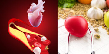 Home remedies to reduce cholesterol, include these things in diet