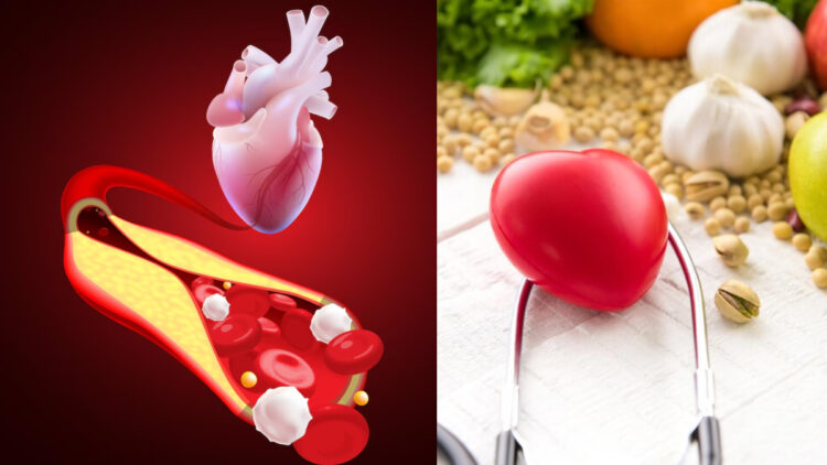 Home remedies to reduce cholesterol, include these things in diet
