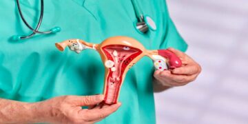 Hormonal changes may also increase the risk of overseas cancer
