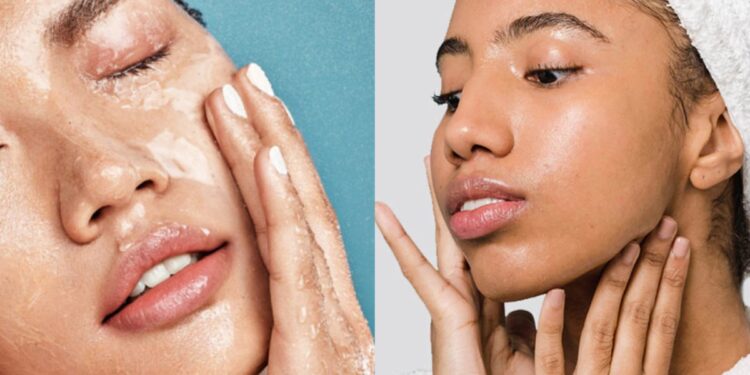 If you are dripping from the face in summer, try these remedies, oily skin will be discharged