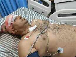 In Jaipur, the sarpanch was beaten with sticks with sticks, learn in the video, came to remove the occupation of the land