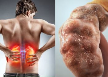 In the beginning, these symptoms start appearing in the beginning of kidney problems, do not forget or not.