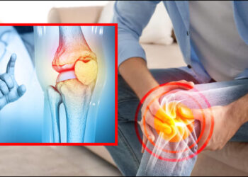 Knee is deteriorating at the age of 30, damage is getting cartilage