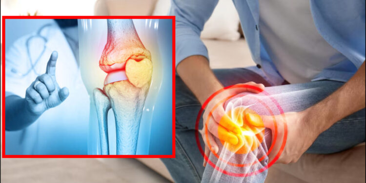 Knee is deteriorating at the age of 30, damage is getting cartilage