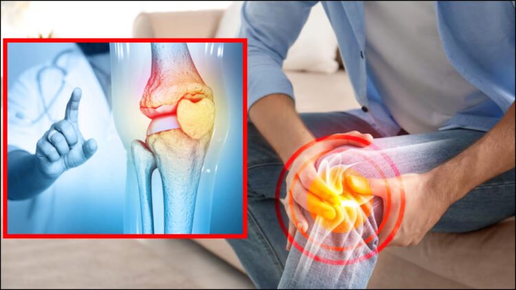 Knee is deteriorating at the age of 30, damage is getting cartilage
