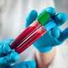 New blood test will quickly identify thousands of rare genetic diseases in children: Research