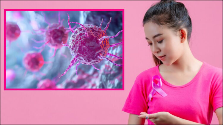 Once breast cancer is cured, what can happen again? Know where it can happen