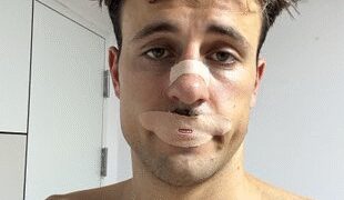 Social media trend of tape on the mouth while sleeping can pose a serious threat: study