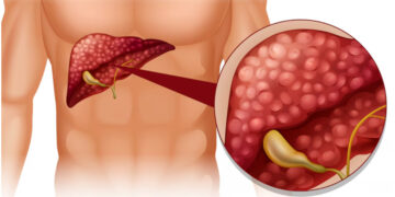 The dirt stored in the liver will be eliminated, drink these drinks rich in medicinal properties on an empty stomach