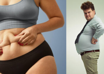 There are many types of belly fat, know which is the fat stored on your stomach and how it will reduce
