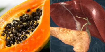 This fruit makes the dirt faster in the liver detox, fatty liver must be in the diet