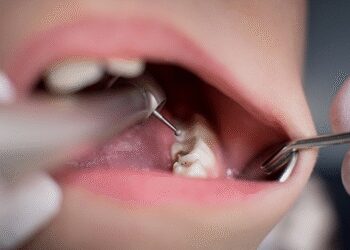 Toothache and pain attack! Get rid of this way